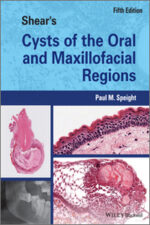 Shear’s Cysts of the Oral and Maxillofacial Regions, 5th Edition
