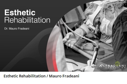 Esthetic Rehabilitation Esthetic and functional integration of the prosthetic rehabilitation