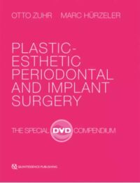 Plastic-Esthetic Periodontal and Implant Surgery: The Special DVD Compendium