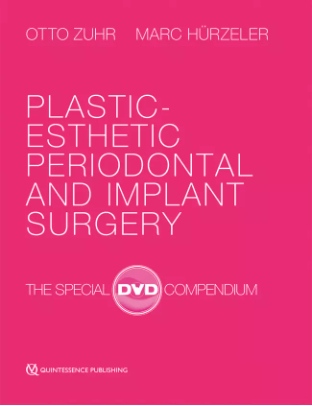 Plastic-Esthetic Periodontal and Implant Surgery