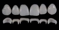 Prosthetic Rehabilitation on Natural Teeth: Predictable, Esthetic and Systematic Steps
