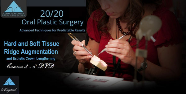 Hard and Soft Tissue Ridge Augmentation and Esthetic Crown Lengthening