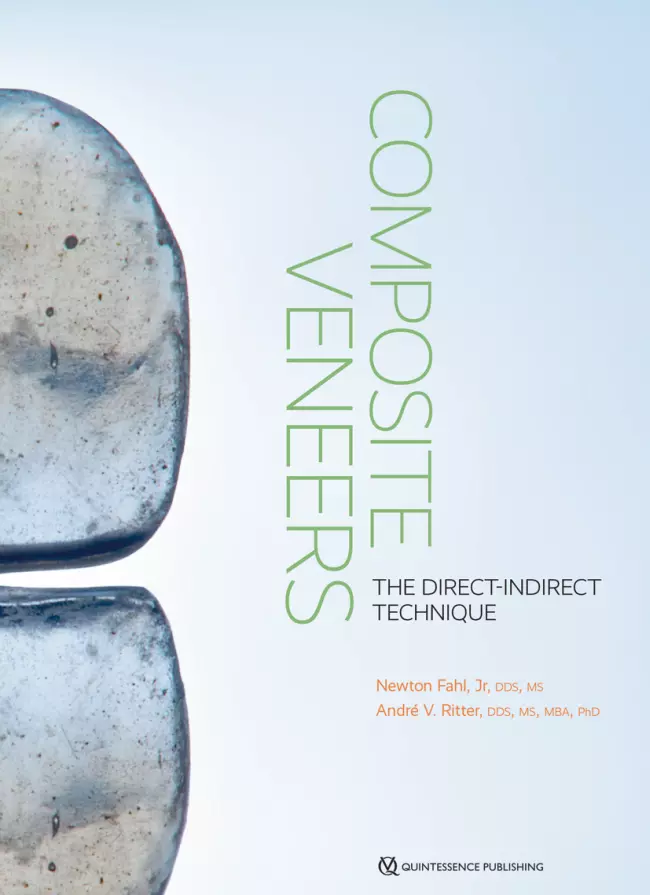 Composite Veneers The Direct-Indirect Technique