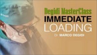 Degidi MasterClass: Immediate Loading Degidi MasterClass: Immediate Loading