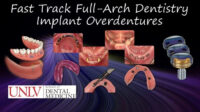 Full-Arch Dentistry – Implant Overdentures Full-Arch Dentistry – Implant Overdentures