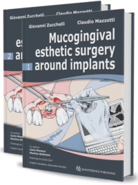 Mucogingival Esthetic Surgery Around Implants ( 2 Volumes)