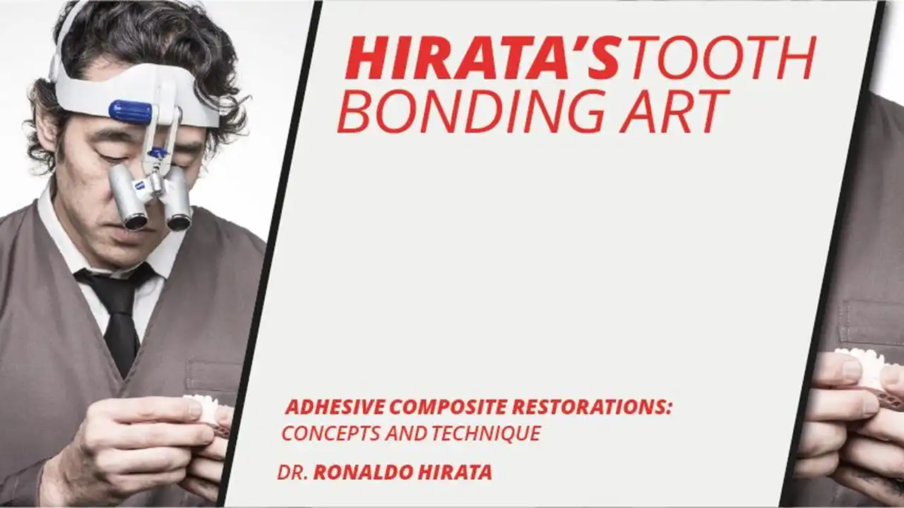 Hirata's tooth bonding art Adhesive composite restorations: concepts and technique
