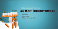 ALL-ON-4 – Implant Prosthetics