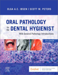 Oral Pathology for the Dental Hygienist, 8th Edition