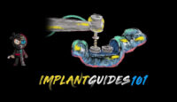 The Implant Guides 101 Course The Implant Guides 101 Course