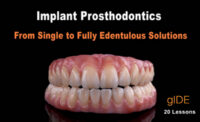 Implant Prosthodontics – From Single to Fully Edentulous Solutions