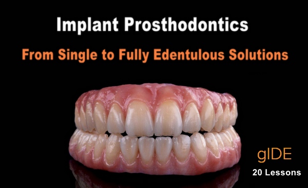 Implant Prosthodontics – From Single to Fully Edentulous Solutions