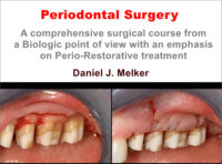 Periodontal Surgery: A Comprehensive Surgical Course