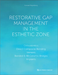 Restorative Gap Management in the Esthetic Zone