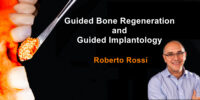 Guided Bone Regeneration and Guided Implantology