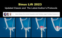 Sinus Lift 2023: Updated Classic & The Latest Author’s Protocols
