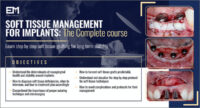 Soft Tissue Management for Implants, The Complete Course