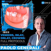 Veneers, Inlay, Onlay, Crowns: Full Protocols Veneers, Inlay, Onlay, Crowns: Full Protocols
