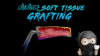 Ninja Soft Tissue Grafting