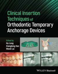 Clinical Insertion Techniques of Orthodontic Temporary Anchorage Devices