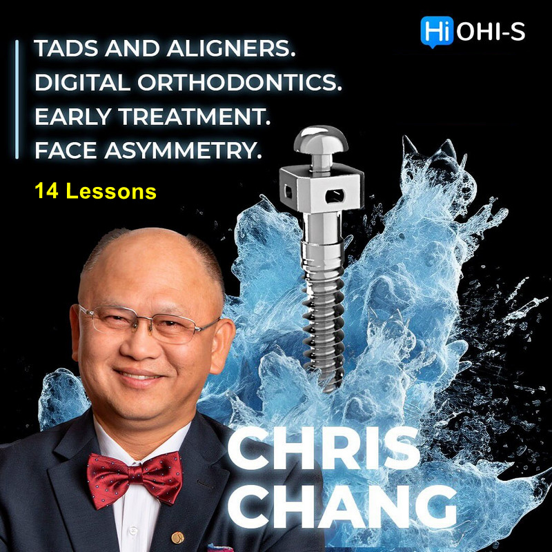 TADs and aligners, Digital orthodontics, Early treatment, Face asymmetry