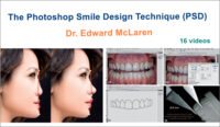 The Photoshop Smile Design Technique (PSD) The Photoshop Smile Design Technique (PSD)
