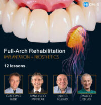 Full-Arch Rehabilitation: Implantation and Prosthetics Full-Arch Rehabilitation: Implantation and Prosthetics