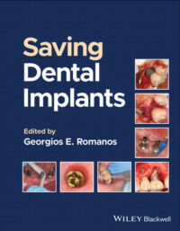 Saving Dental Implants Saving Dental Implants