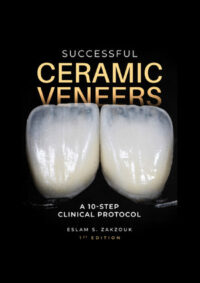 Successful Ceramic Veneers: 10 Steps Clinical Protocol