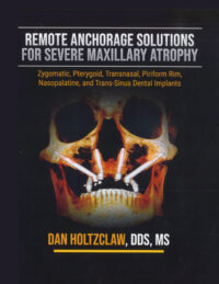 Remote Anchorage Solutions for Severe Maxillary Atrophy (Scanned Copy) Remote Anchorage Solutions for Severe Maxillary Atrophy (Scanned Copy)