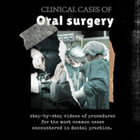 Clinical Cases of Oral Surgery