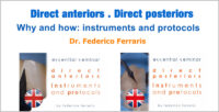Direct Anteriors and Direct Posteriors – Why and how: instruments and protocols.