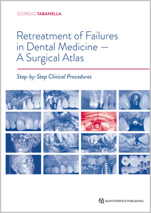 Retreatment of Failures in Dental Medicine - A Surgical Atlas