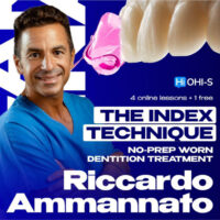 The Index Technique: No-prep Worn Dentition Treatment
