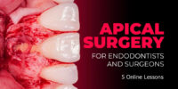 Apical Surgery for Endodontists and Surgeons