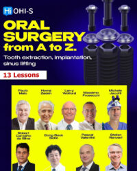 Oral Surgery from A to Z. Tooth Extraction, Implantation, Sinus Lifting