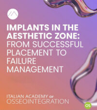 Implants in the Aesthetic Zone: From Successful Placement to Failure Management