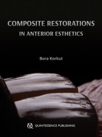 Esthetic Anterior Composite Restorations (Scanned PDF Copy)