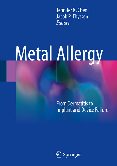 Metal Allergy: From Dermatitis to Implant and Device Failure Metal Allergy: From Dermatitis to Implant and Device Failure