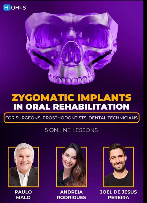 Zygomatic Implants in Oral Rehabilitation: For surgeons, prosthodontists, dental technicians Zygomatic Implants in Oral Rehabilitation: For surgeons, prosthodontists, dental technicians