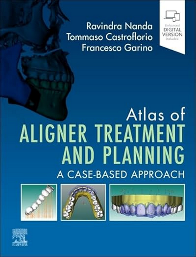 Atlas of Aligner Treatment and Planning: A Case-Based Approach (Epub & Converted PDF Copy) Atlas of Aligner Treatment and Planning: A Case-Based Approach (Epub & Converted PDF Copy)